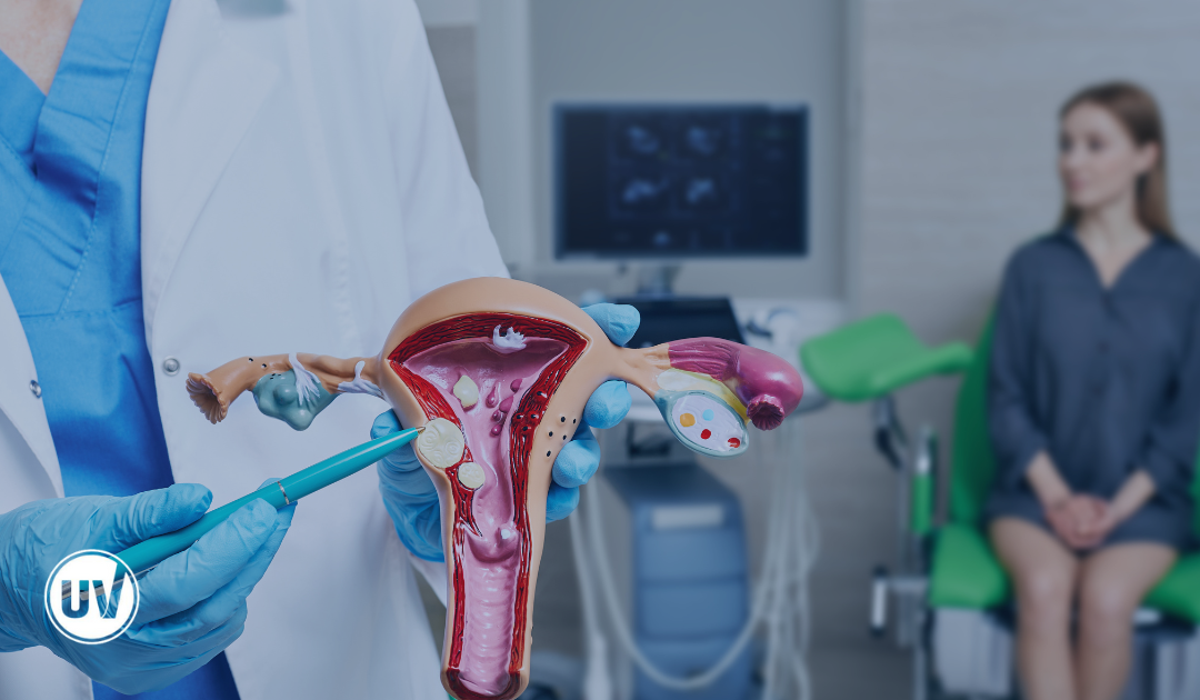 Are Fibroids Quietly Wreaking Havoc on Your Urinary Health?