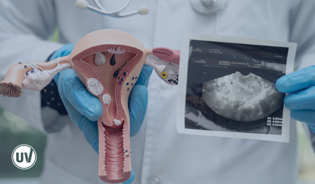 Adenomyosis vs Fibroids: Unlocking the Key Differences for Effective Treatment