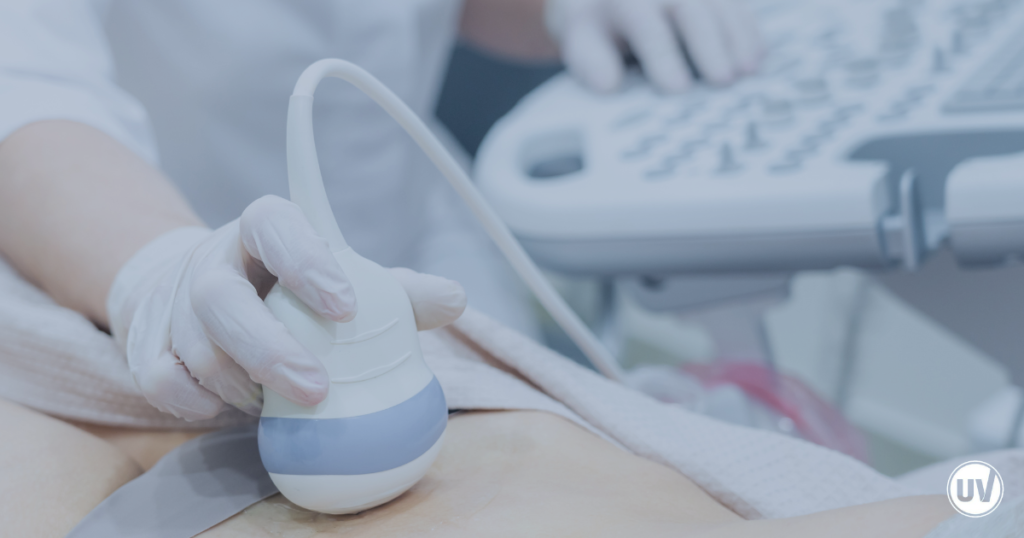 Image of vascular specialist using an ultrasound imaging on a patient with fibroids