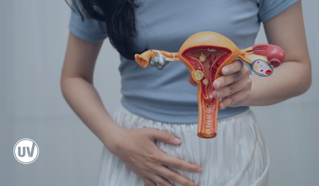 Do I Have Fibroids or Endometriosis? Understanding the Signs and Symptoms