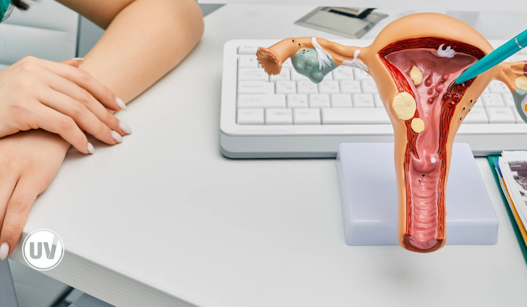 Cervical Polyps vs. Fibroids: What's the Difference?